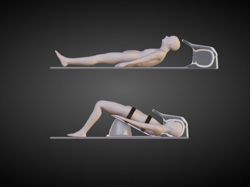 MRI head coil: without KyphoLift the head misses the coil; with it, anatomy is in the coil